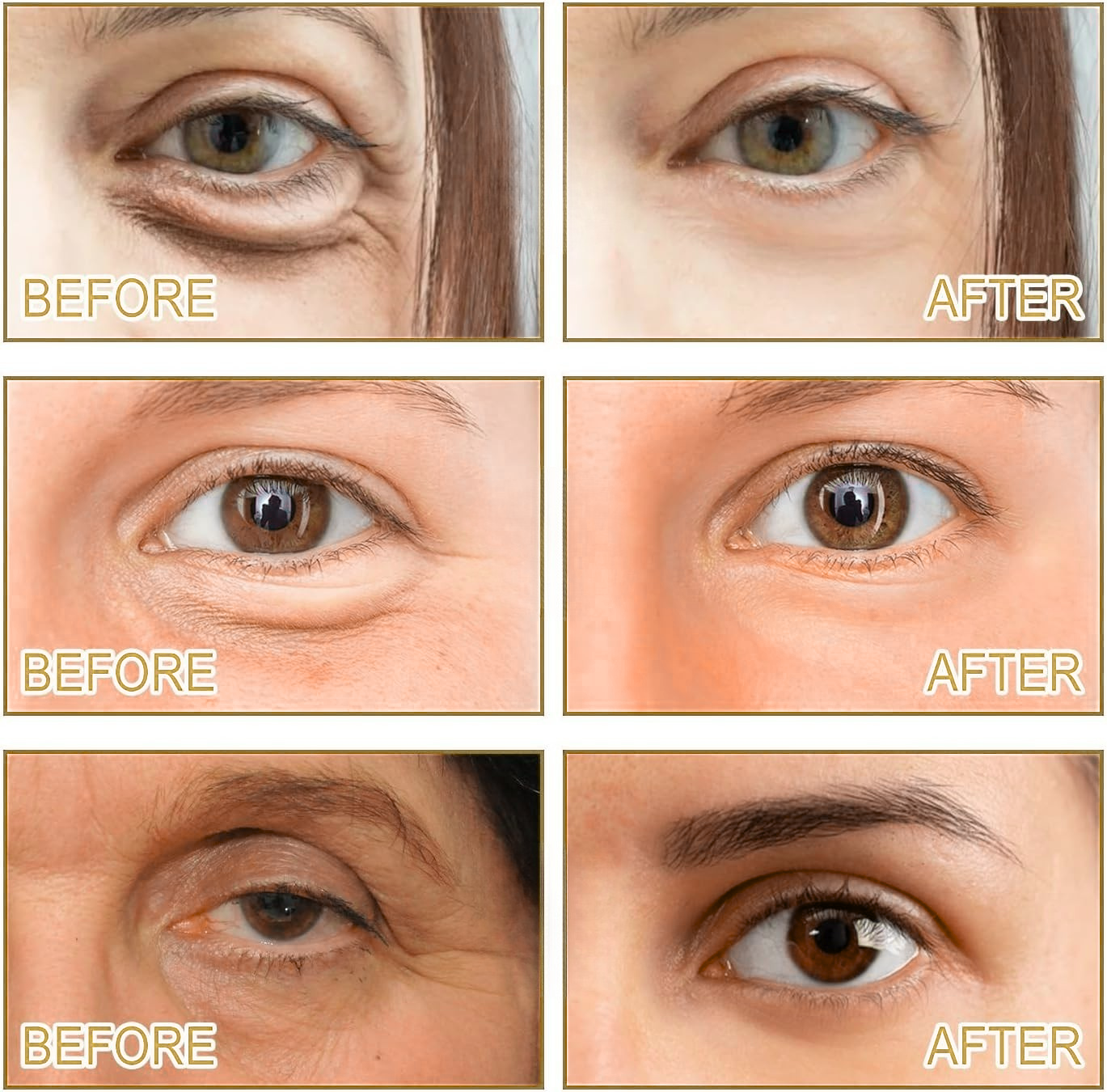 Nuvéra™ Microneedle Patches