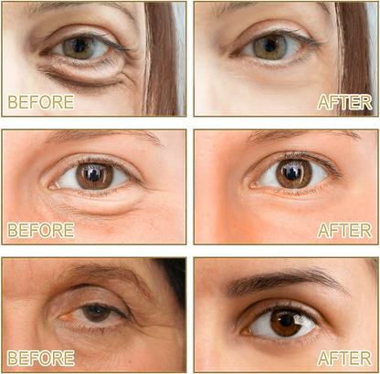 Nuvéra™ Microneedle Patches